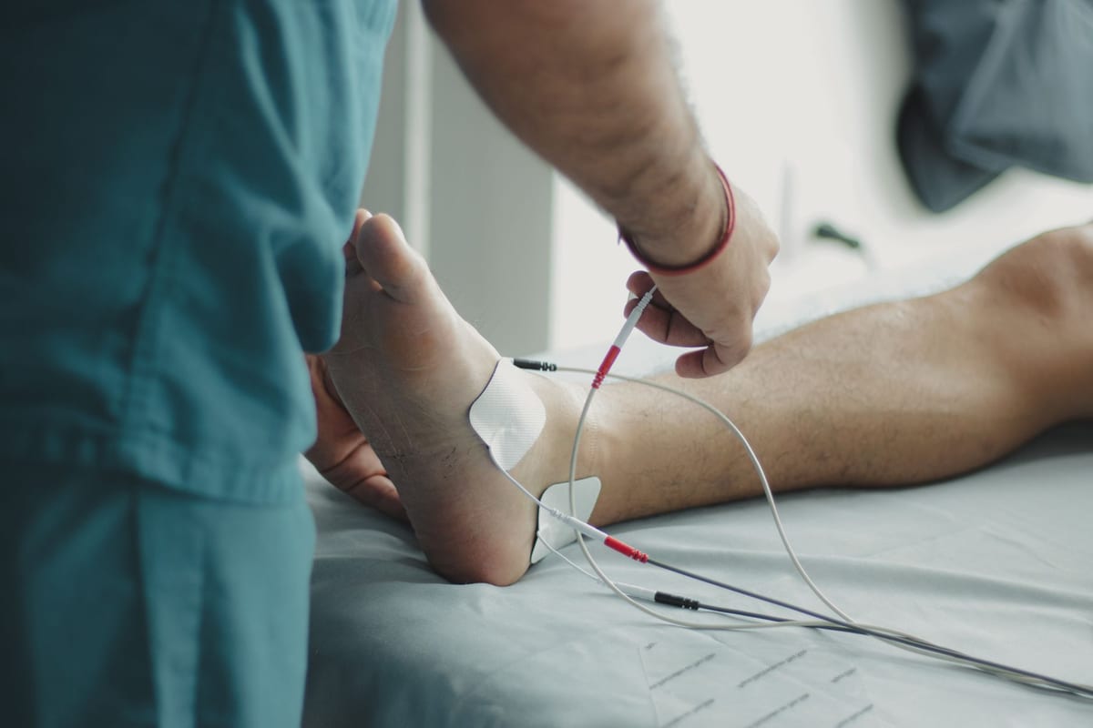 Electrode pads placed around a patient's ankle during treatment